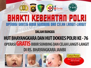 Polda Jambi Bersama RS  Bhayangkara Gelar  Operasi Bibir Sumbing dan Celah Langit-langit Gratis